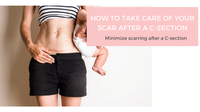 How to take care of your scar after a C-Section
